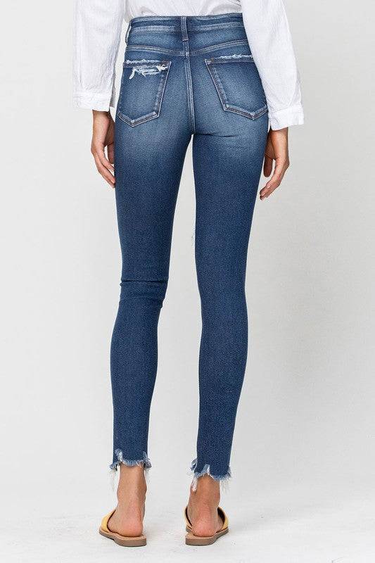 High Rise Patched Button Up Raw Hem Ankle Skinny Eye Candy Sensation
