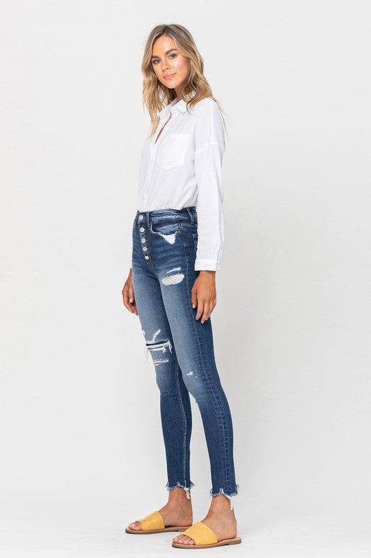 High Rise Patched Button Up Raw Hem Ankle Skinny Eye Candy Sensation